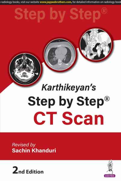 Karthikeyan Step by Step CT scan
